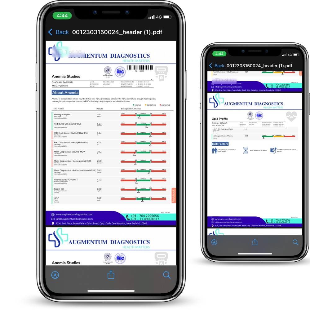 Smart Report Mobile View
