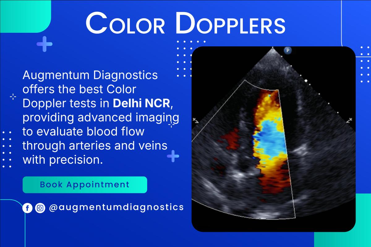 Color Doppler